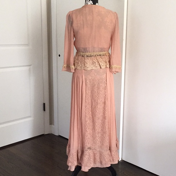 Lace Button Top and Skirt - Picture 2 of 5